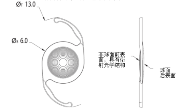 愛(ài)爾康三焦點(diǎn)