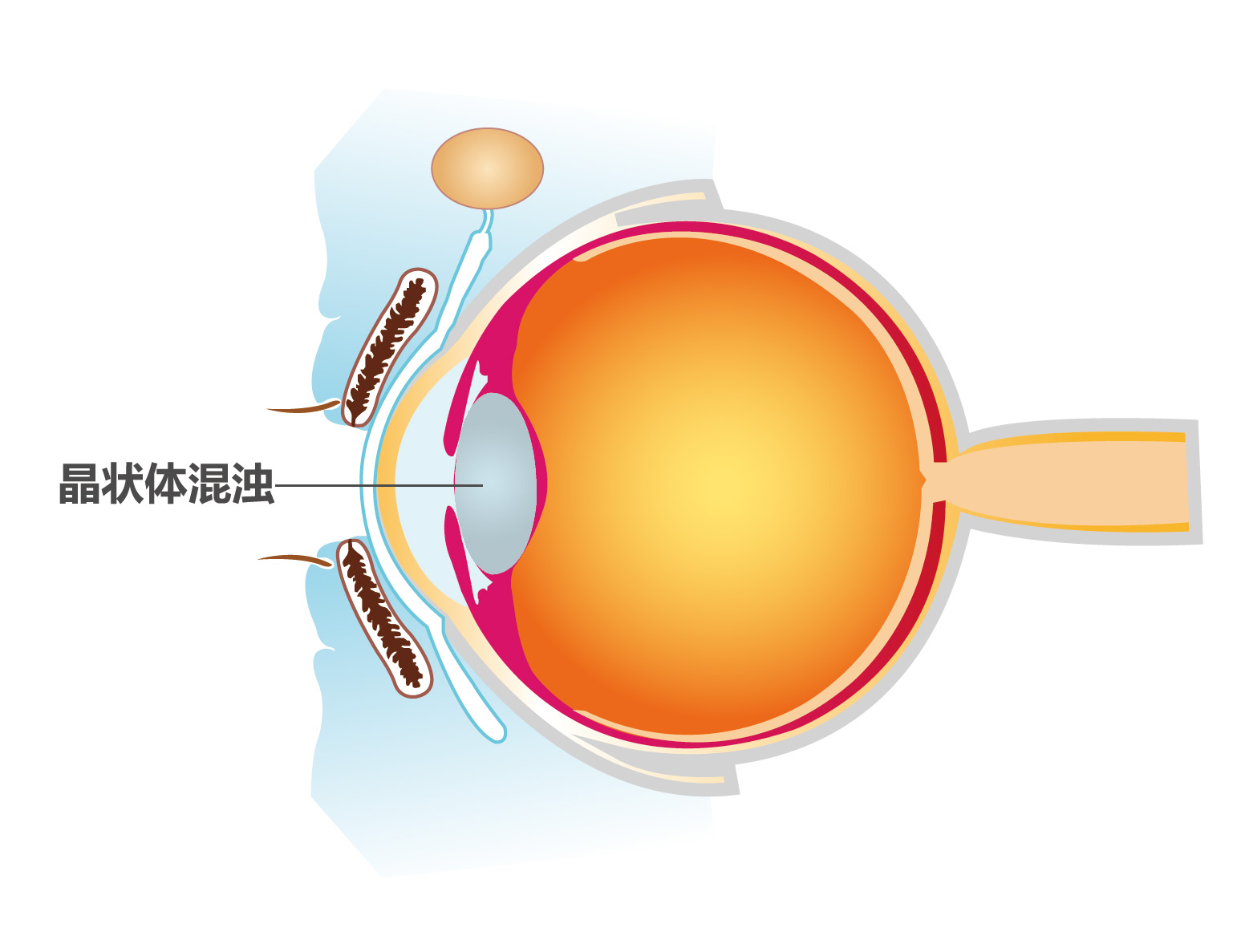 老花眼癥狀