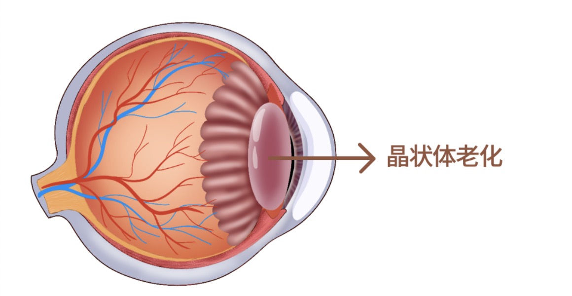 老花眼原理