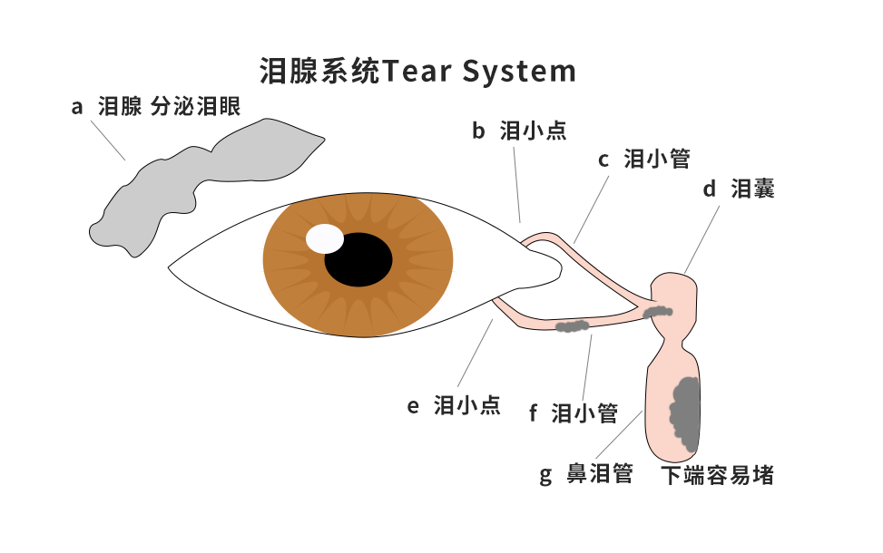 淚囊炎